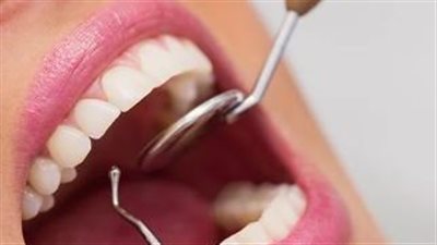 أسباب تخلخل الأسنان