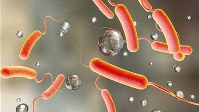 طبيب يوضح أعراض الكوليرا وخطورتها وطرق الوقاية منها