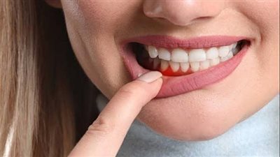 أمراض اللثة تزيد خطر الشيخوخة بنسبة 70%