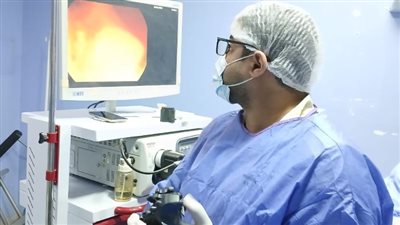 إجراء 6 مناظير مرارية وقولونية بكفاءة في مستشفى بلبيس 