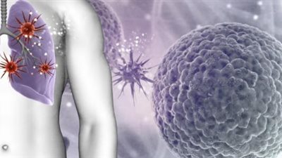 علماء يطورون برمجيات لتشخيص أمراض الرئة والأوعية الدموية