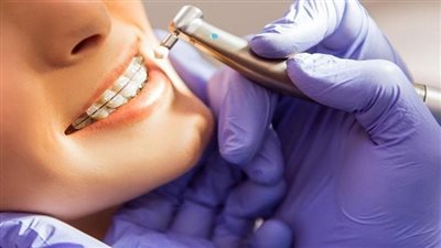 أخصائي: عدم تكوين الأسنان عند الأطفال سببه خلل جيني