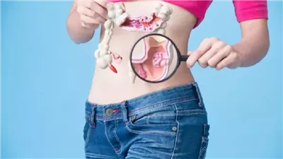 احذر.. أمراض تزيد من خطر الإصابة بسرطان القولون