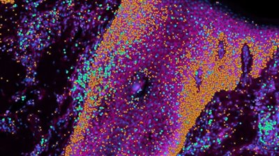 أخيرًا.. دراسة تفك شفرة تكون الجلد البشري