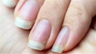 عناصر غذائية تفيد صحة الأظافر 