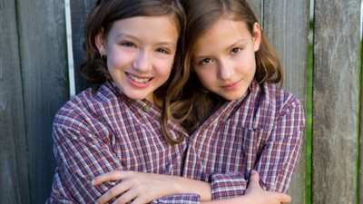 التوائم الملتصقة في المواريث.. كيف كفل الإسلام حقوقهم؟