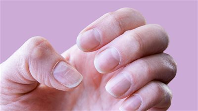 6 أطعمة تعزز من قوة الأظافر وصحتها