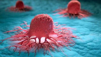 علماء يطورون عقار جديد يهاجم الخلايا السرطانية دون الإضرار بالسليمة