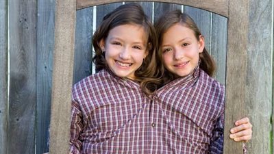 الإفتاء توضح كيف ترث التوائم الملتصقة