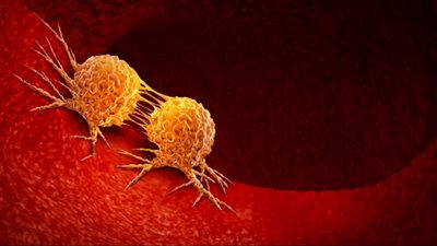 7 عادات شائعة تزيد من خطر الإصابة بالسرطان