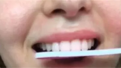 طبيب يحذر من مشروب شائع قد يضر بصحة الأسنان