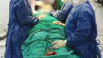 جراحة متقدمة لاستئصال ورم سرطاني بالغدة الدرقية بمستشفى ههيا المركزي