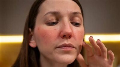 5 نصائح فعالة للتخلص من انتفاخ الوجه