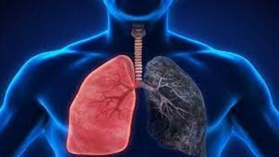 الانسداد الرئوي.. الأسباب وطرق العلاج