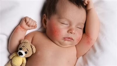 طبيب يحذر من تقبيل الرضيع أقل من 3 شهور .. لهذا السبب 