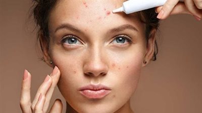 علاج تصبغات البشرة باستخدام مكونات طبيعية