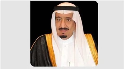 السعودية تنظم مؤتمر دولي للتوائم الملتصقة 