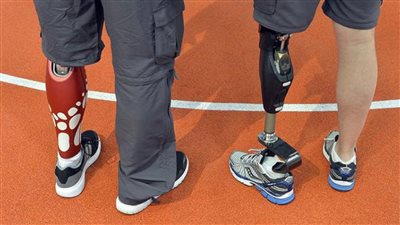 الإفتاء: لا حرج في تركيب طرف صناعي إذا ولد الشخص بعِلة