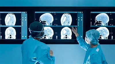 دراسة: ارتفاع الوفيات المبكرة بالسرطان في 2025