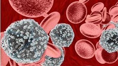 %70 من المراهقين المصابين بالإيدز.. فتيات