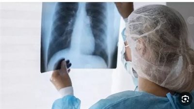 في أمريكا.. معدّل إصابة النساء بسرطان الرئة أعلى من الرجال