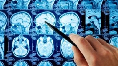 ابتكار حبر سائل لقياس الدماغ يساعد على تشخيص الأمراض العصبية