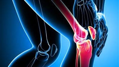 دراسة تكشف العلاقة بين تناول الأطعمة المصنعة وهشاشة الركبة