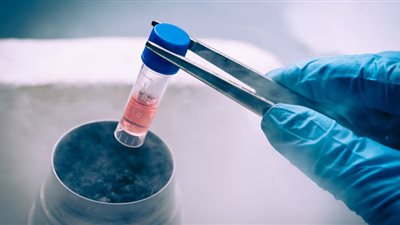 العلاج بالخلايا الجذعية.. أمل جديد في علاج الأمراض المزمنة