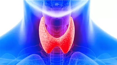 هل يسبب الإجهاد الإصابة بأمراض الغدة الدرقية؟.. طبيب يوضح