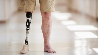 هل الأطراف الصناعية تعد من الصدقة الجارية؟