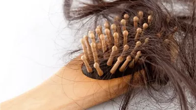 طبيبة تكشف علاقة الأمراض الفيروسية بتساقط الشعر