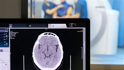 دراسة: مشاهدة التلفزيون لساعات طويلة يسرع الإصابة بالخرف 