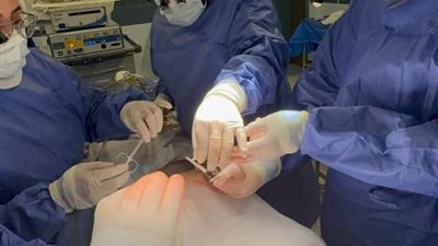 إنجاز طبي بجامعة القناة.. نجاح عملية لإنقاذ مريضة تعاني من مشاكل قلبية 