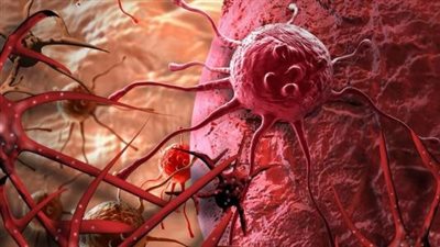 ابتكار خارق.. علماء ينجحون في القضاء على 99 % من الخلايا السرطانية بهذه الطريقة