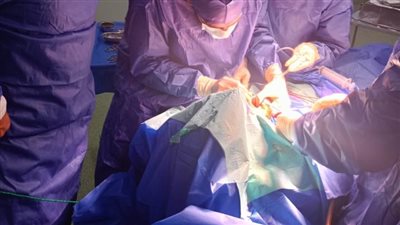 للمرة الأولى.. إجراء جراحة وجه وفكين دقيقة بمستشفى الحسينية المركزي 