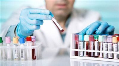 اختفاء مئات العينات الفيروسية القاتلة من مختبر أسترالى يثير قلقاً عالمياً