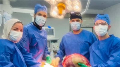 أطباء مستشفى  الفيوم الجامعي يستئصلون ورم 15  كيلو من بطن مسنة