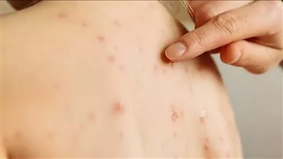 الخبراء يرسمون روشتة النجاة من VSXAS
