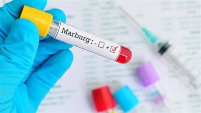 8 وفيات بتنزانيا من فيروس ماربورغ والصحة العالمية تحذر