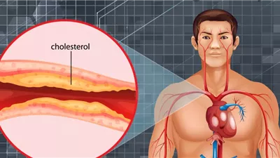 أطعمة تنظف الشرايين وتحافظ على صحة القلب طبيعيًا