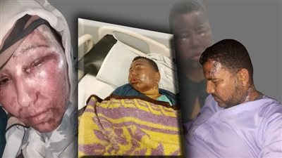 الأمن يضبط المتهمين بتشويه عائلة بماء النار