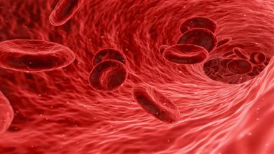 اكثر الأمراض انتشار(فقر الدم الأنيميا )