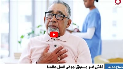 ينتشر في صمت .. تفشٍ غير مسبوق لمرض السل عالميا (فيديو)