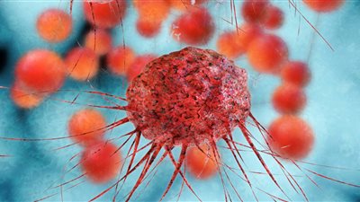 طبيب أورام يحدد الأسباب الرئيسية للسرطان