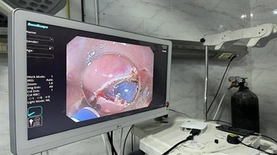 الصحة تعلن نجاح الطاقم الطبي بمستشفى منيا القمح المركزي في تقنية الفراغ الثالث