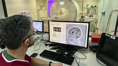 ثورة في التشخيص المبكر لمرض الصرع عبر الذكاء الاصطناعي 