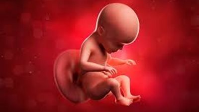 إنقاذ جنين من الإصابة بضمور العضلات الشوكي قبل ولادته