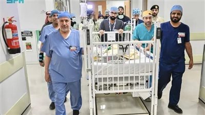 نجاح فصل التوأم الملتصق البوركيني 