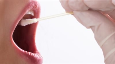 أعراض شائعة تتعلق باللعاب تشير إلى الإصابة بمرض قاتل 