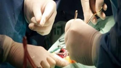 الدقهلية: نجاح فريق طبى بمستشفتي المنزلة والجمالية في انقاذ حياة طفل